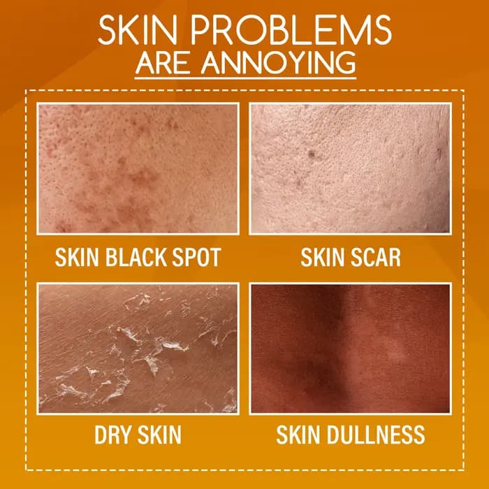 Lotion Peeling à l'orange pour la peau foncée, exfoliante, élimine les peaux mortes, nettoyage, hydratant, éclaircissant, huile de Peeling forte